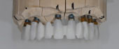 The structure of zirconium dioxide on a model (laboratory phase). 
