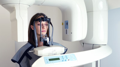 3D scanning